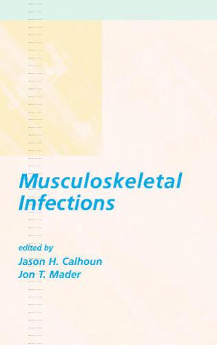 Musculoskeletal Infections