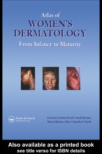 Atlas of Women's Dermatology: From Infancy to Maturity