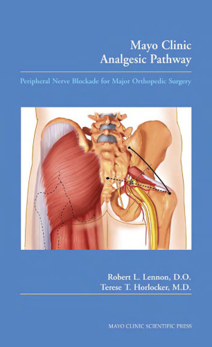 Mayo Clinic Analgesic Pathway: Peripheral Nerve Blockade for Major Orthopedic Surgery