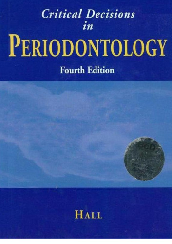 Critical decisions in periodontology