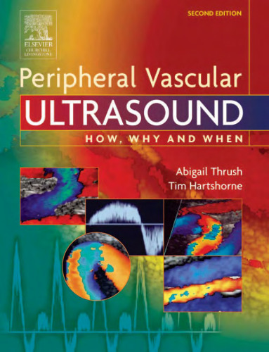 Peripheral Vascular Ultrasound How Why and When