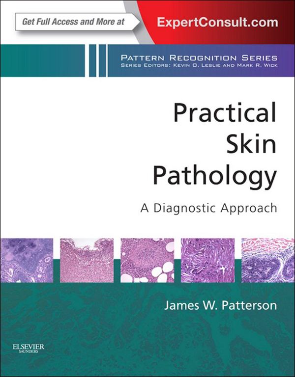 Practical Skin Pathology: A Diagnostic Approach