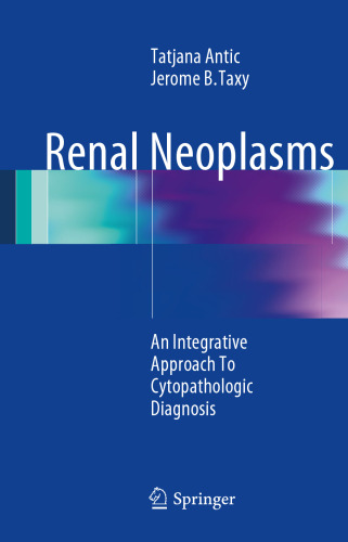 Renal Neoplasms: An Integrative Approach To Cytopathologic Diagnosis