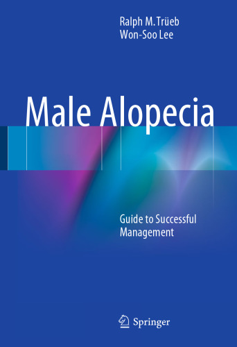 Male Alopecia: Guide to Successful Management