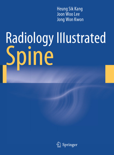 Radiology Illustrated: Spine