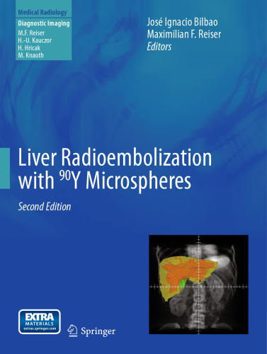 Liver Radioembolization with 90Y Microspheres