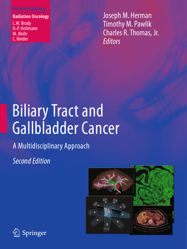 Biliary Tract and Gallbladder Cancer: A Multidisciplinary Approach