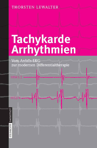 Tachykarde Arrhythmien: Vom Anfalls-EKG zur modernen Differentialtherapie