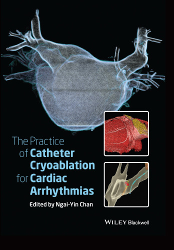 The Practice of Catheter Cryoablation for Cardiac Arrhythmias