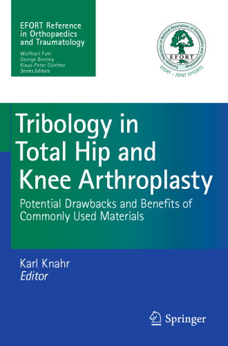 Tribology in Total Hip and Knee Arthroplasty: Potential Drawbacks and Benefits of Commonly Used Materials