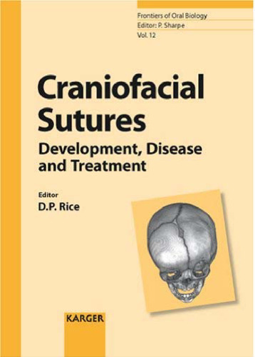 Craniofacial sutures : development, disease and treatment