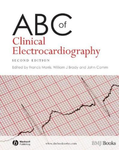 ABC of clinical electrocardiography