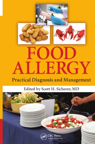 Food Allergy: Practical Diagnosis and Management