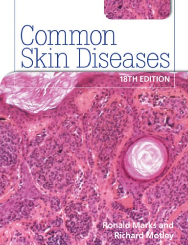 Common Skin Diseases 18th edition