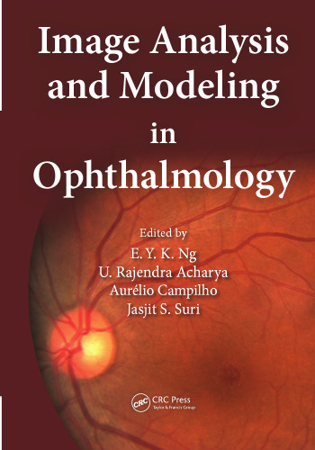 Image Analysis and Modeling in Ophthalmology