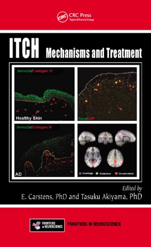 Itch: Mechanisms and Treatment