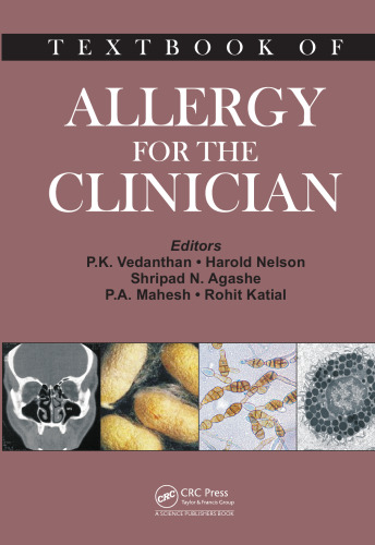 Textbook of Allergy for the Clinician