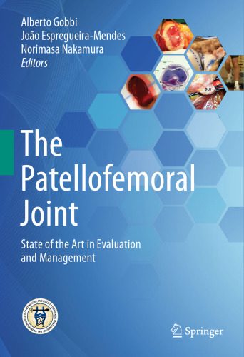 The Patellofemoral Joint: State of the Art in Evaluation and Management