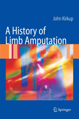 A History of Limb Amputation 1st ed