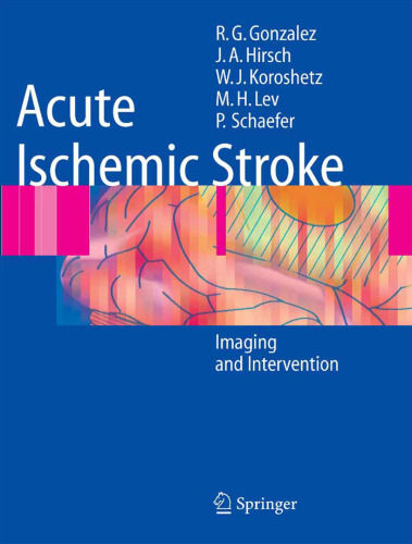 Acute Ischemic Stroke Imaging and Intervention