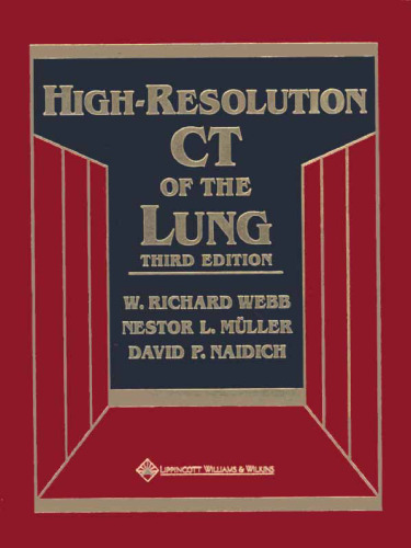 High-Resolution CT of the Lung