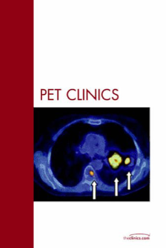 Breast Cancer, An Issue of PET Clinics