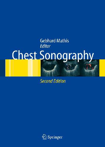 Atlas of Chest Sonography