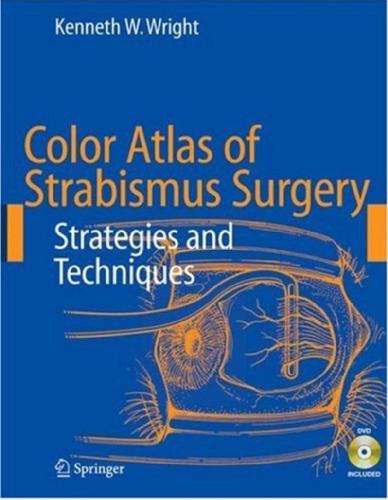 Color Atlas of Strabismus Surgery Strategies and Techniques