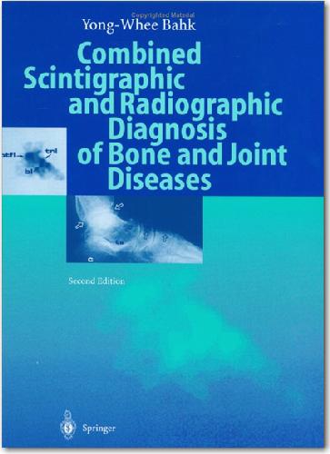 Combined Scintigraphic and Radiographic Diagnosis of Bone and Joint Diseases