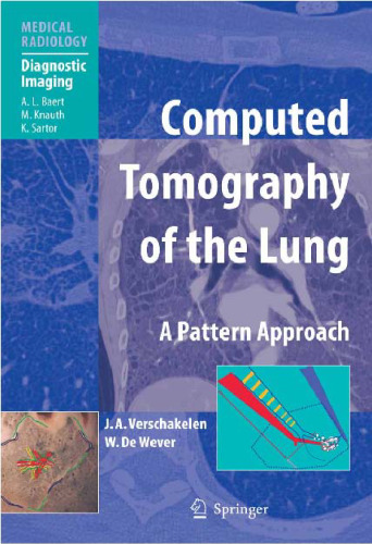 Computed Tomography of the Lung A Pattern Approach