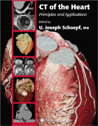 CT of the Heart Principles and Applications