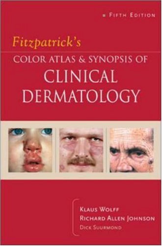 Fitzpatrick's Color Atlas & Synopsis of Clinical Dermatology