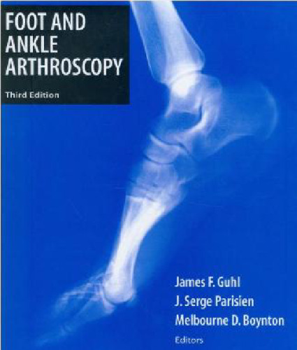 Foot and Ankle Arthroscopy