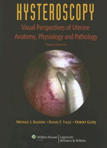 Hysteroscopy: Visual Perspectives of Uterine Anatomy, Physiology, and Pathology