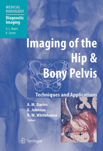 Imaging of the Hip & Bony Pelvis