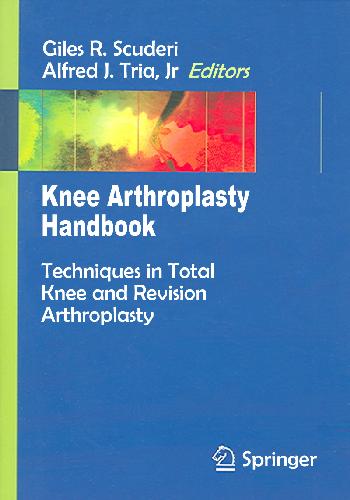 Knee Arthroplasty Handbook: Techniques in Total Knee and Revision Arthroplasty