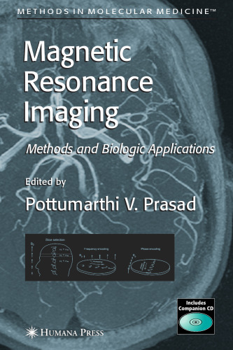 Magnetic Resonance Imaging: Methods and Biologic Applications 