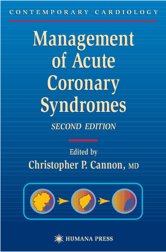 Management of Acute Coronary Syndromes. Contemporary Cardiology