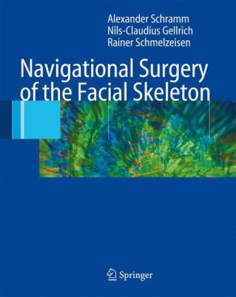 Navigation and MIS in Orthopedic Surgery