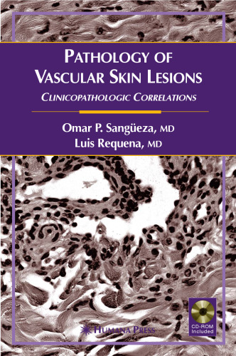 Pathology of Vascular Skin Lesions