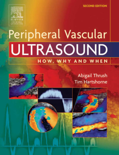 Peripheral Vascular Ultrasound