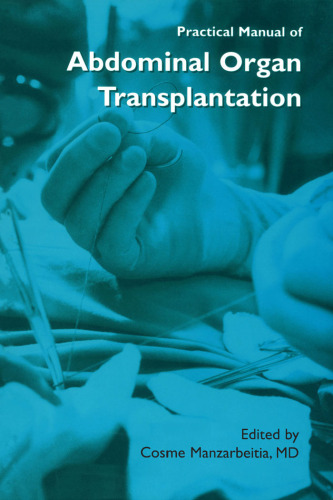 Practical Manual of Abdominal Organ Transplantation