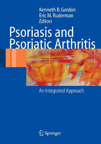 Psoriasis and Psoriatic Arthritis An Integrated Approach