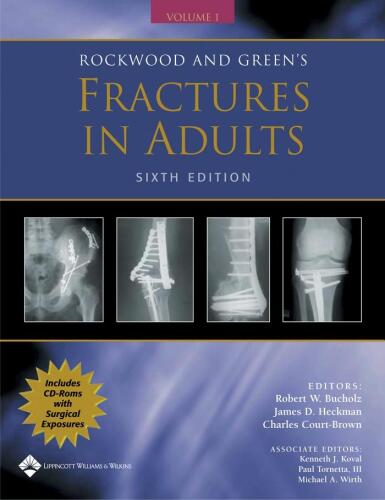 Rockwood and Wilkins' Fractures in Children