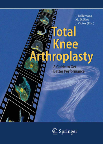 Total Knee Arthroplasty