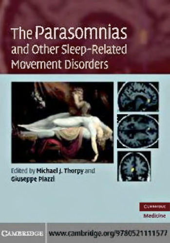 The Parasomnias and Other Sleep-Related Movement Disorders