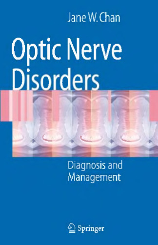 Optic Nerve Disorders: Diagnosis and Management