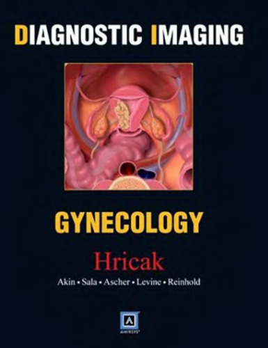 Diagnostic Imaging: Gynecology