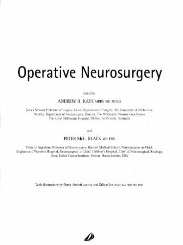 Operative Neurosurgery