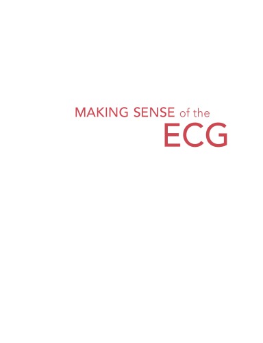 Making Sense of the ECG:  A Hands-On Guide, Fourth Edition